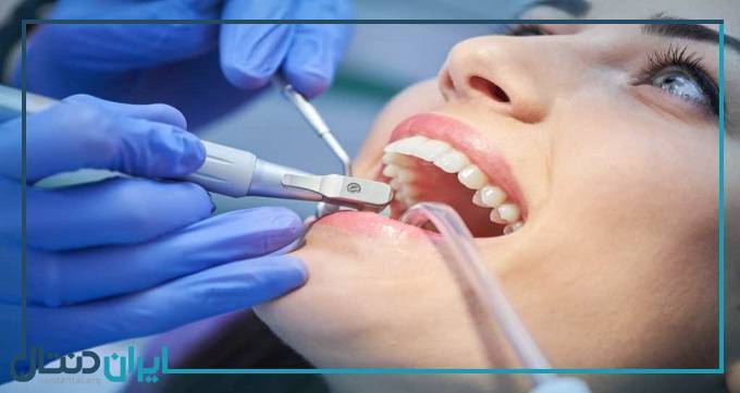 بهترین دندانپزشک زیبایی و ترمیمی در رشت【سال1402】❤️+ لیست 10 تایی - خبرخوان تی شین