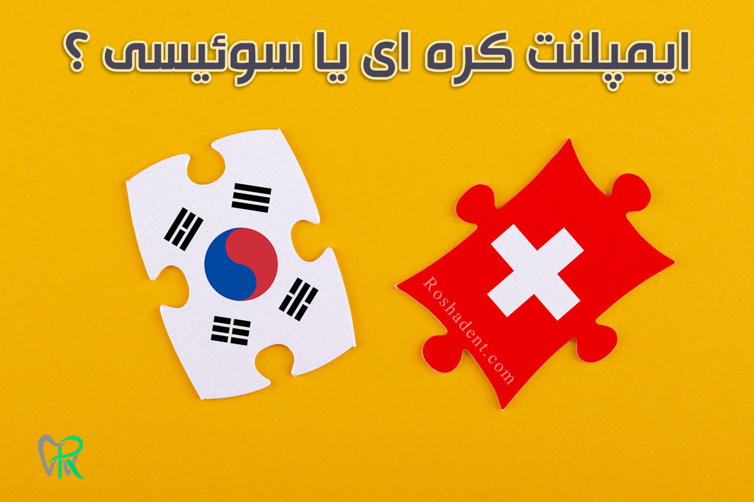 مقایسه تفاوت ایمپلنت کره ای با سوئیسی - خبرخوان تی شین